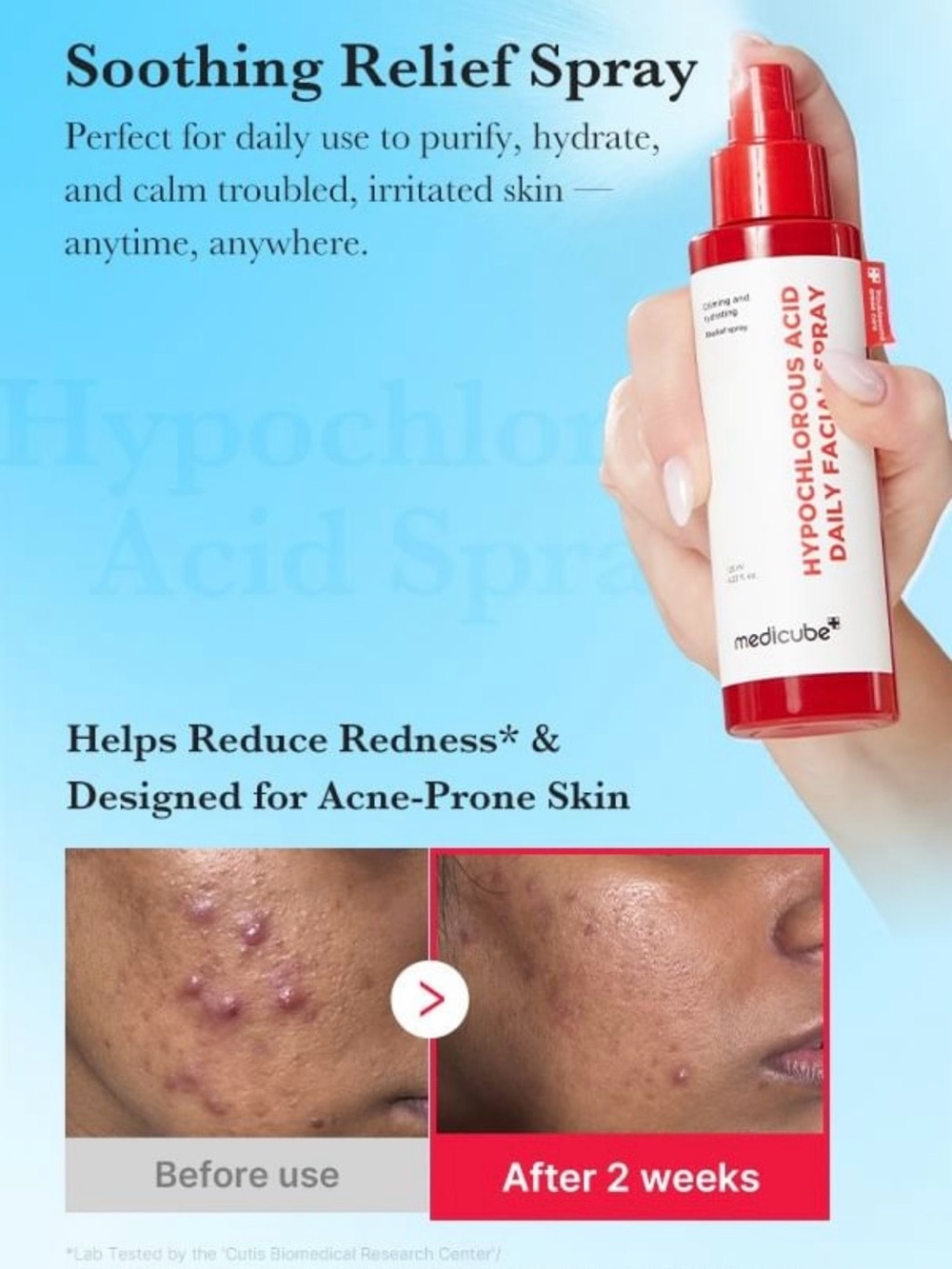 Medicube Hypochlorous Acid Daily Facial Spray - Picture 6 of 6